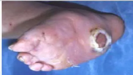 Orthopedic Prometric Exam Question