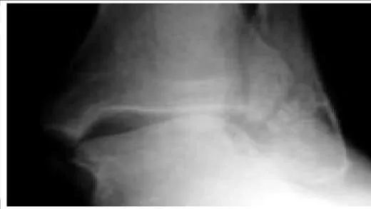 Orthopedic Prometric Exam Question