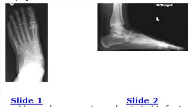 Orthopedic Prometric Exam Question