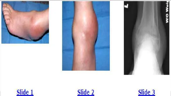 Orthopedic Prometric Exam Question