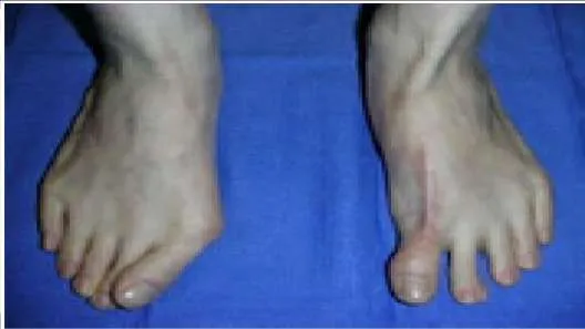 Orthopedic Prometric Exam Question