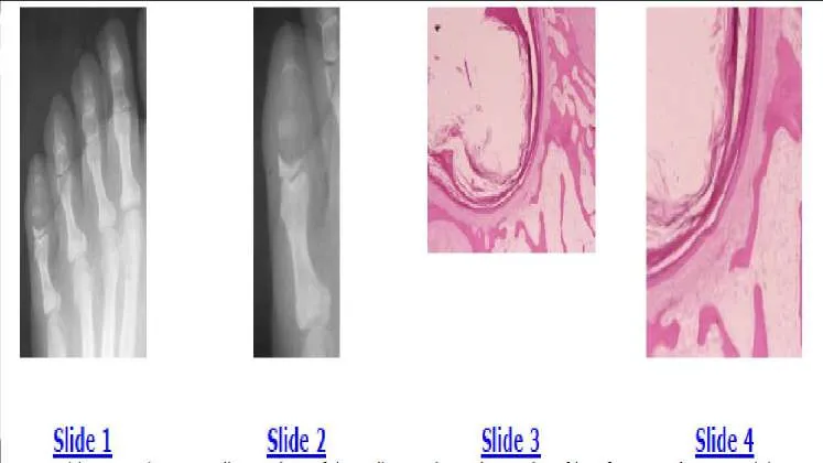 Orthopedic Prometric Exam Question
