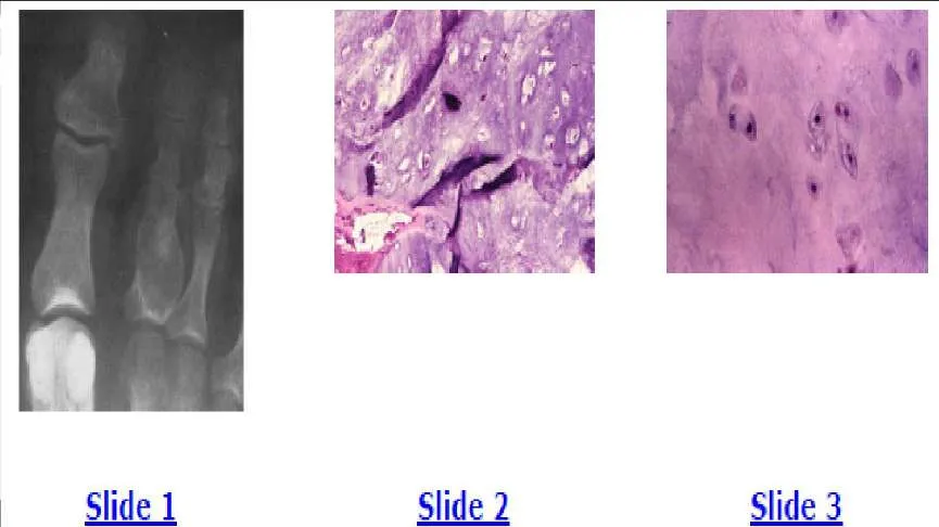 Orthopedic Prometric Exam Question