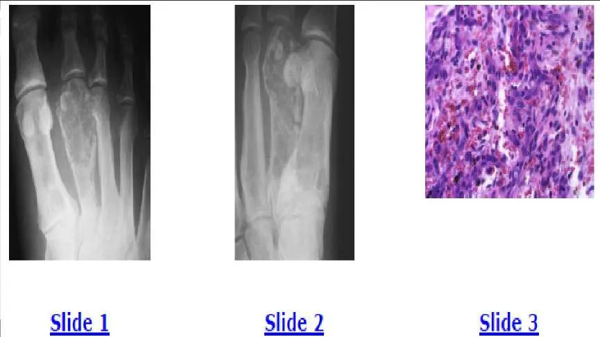 Orthopedic Prometric Exam Question