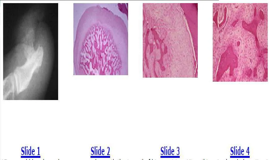 Orthopedic Prometric Exam Preparation MCQs - Part 5