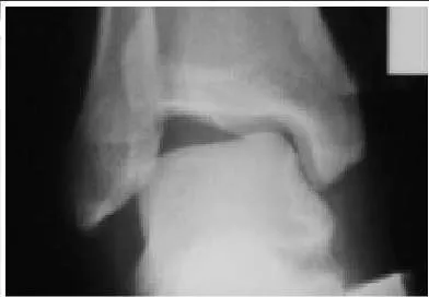 Orthopedic Prometric Exam Question