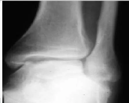 Orthopedic Prometric Exam Question