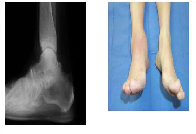 Orthopedic Prometric Exam Preparation MCQs - Part 1