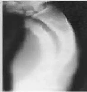 Orthopedic Prometric Exam Question