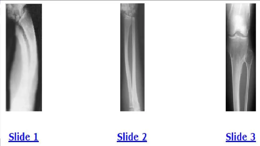 Orthopedic Prometric Exam Question