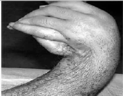 Orthopedic Prometric Exam Question