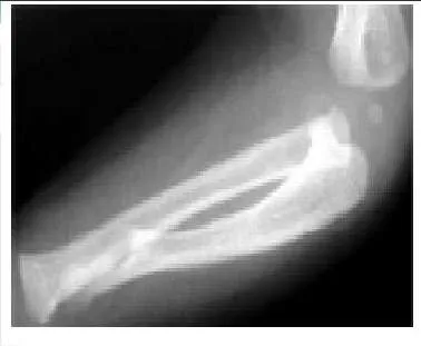 Orthopedic Prometric Exam Preparation MCQs - Part 11