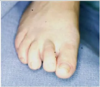 Orthopedic Prometric Exam Question