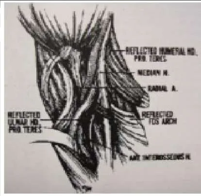 Orthopedic Prometric Exam Question