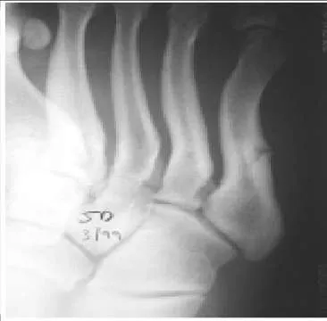 Orthopedic Prometric Exam Question