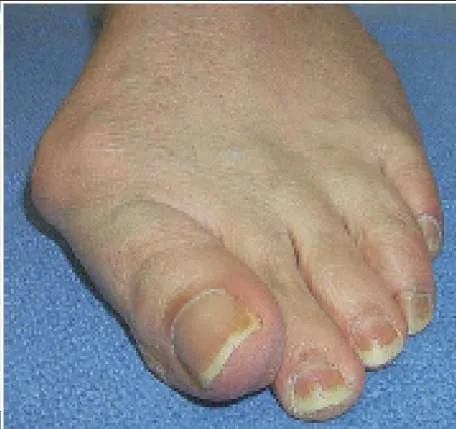 Orthopedic Prometric Exam Question