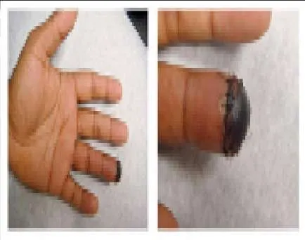 Orthopedic Prometric Exam Preparation MCQs - Part 13