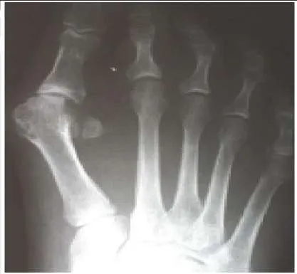 Orthopedic Prometric Exam Question