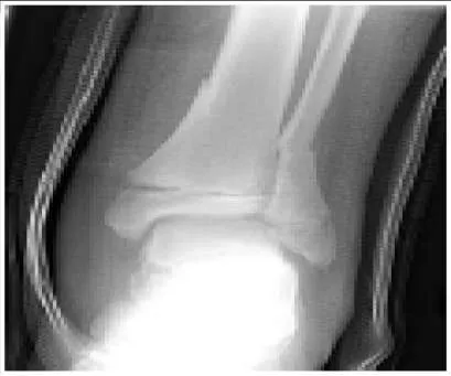 Orthopedic Prometric Exam Preparation MCQs - Part 15