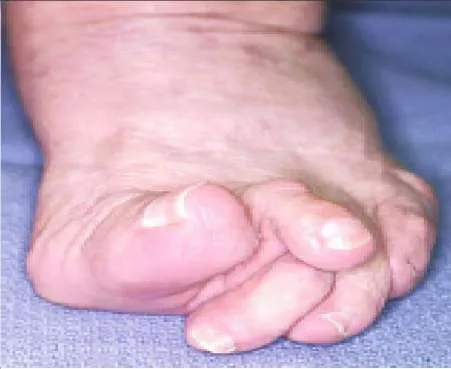 Orthopedic Prometric Exam Question