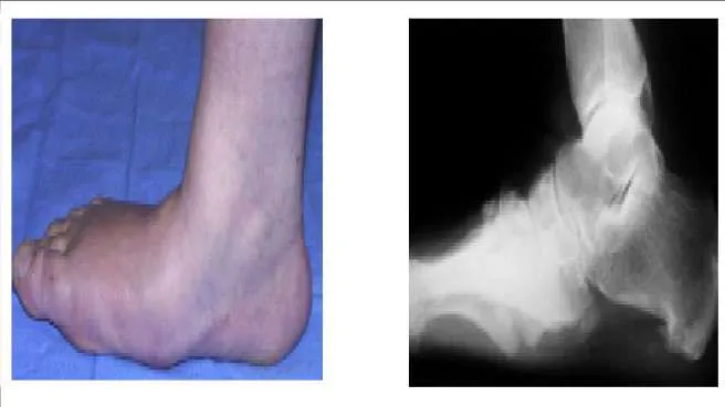 Orthopedic Prometric Exam Question