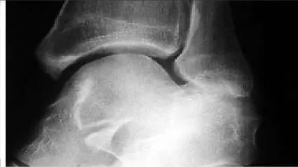 Orthopedic Prometric Exam Question