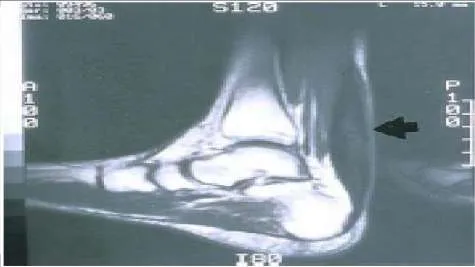 Orthopedic Prometric Exam Question