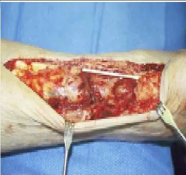 Orthopedic Prometric Exam Question