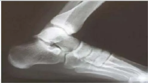 Orthopedic Prometric Exam Question