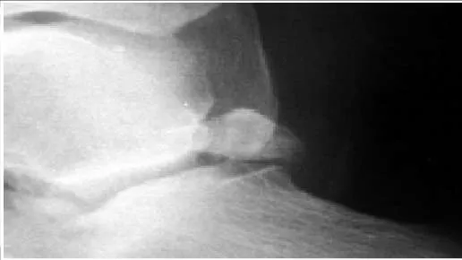 Orthopedic Prometric Exam Preparation MCQs - Part 2