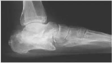 Orthopedic Prometric Exam Question