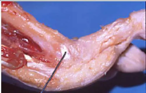 Orthopedic Prometric Exam Question