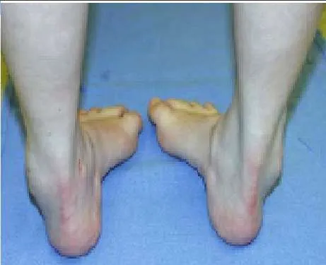 Orthopedic Prometric Exam Question