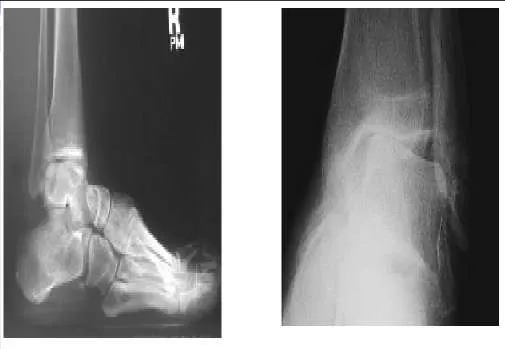 Orthopedic Prometric Exam Question