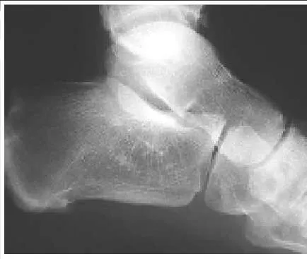 Orthopedic Prometric Exam Question