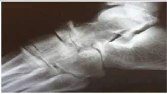 Orthopedic Prometric Exam Question