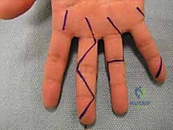 التشريح الدموي والعصبي الدقيق