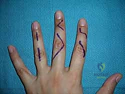 تجهيزات العمليات الجراحية المتقدمة