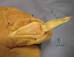 تفاصيل الجراحة الميكروسكوبية الدقيقة