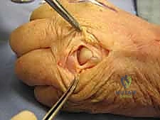 جلسات العلاج الطبيعي والتأهيل الحركي