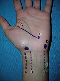 Intraoperative Surgical Step
