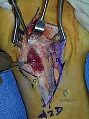 الأستاذ الدكتور محمد هطيف أثناء تقييم حالة معقدة