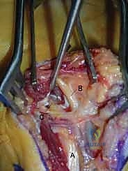 الدقة المتناهية في اتخاذ القرارات الجراحية