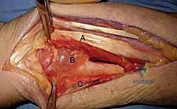 تمارين استعادة مرونة الأوتار والمفاصل