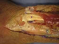 خطوات متقدمة في جراحة العظام والمفاصل