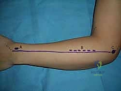 تفاصيل الأوتار والأعصاب في اليد