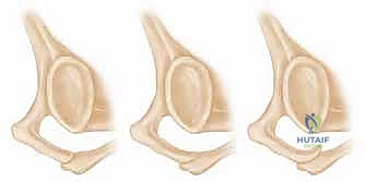 الأوتار والعضلات الداعمة لمفصل الكتف