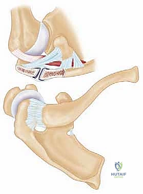 العلاج التحفظي لآلام الكتف