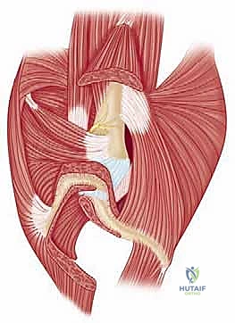 خطوات جراحة الكتف خطوة بخطوة