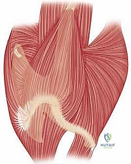 عمليات استبدال مفصل الكتف المعقدة